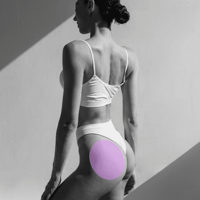 Glutes Laser Hair Removal (3PK) at The Skin Addict by Megan in White Plains, NY