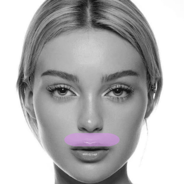 Lip Laser Hair Removal (3PK) at The Skin Addict by Megan in White Plains, NY