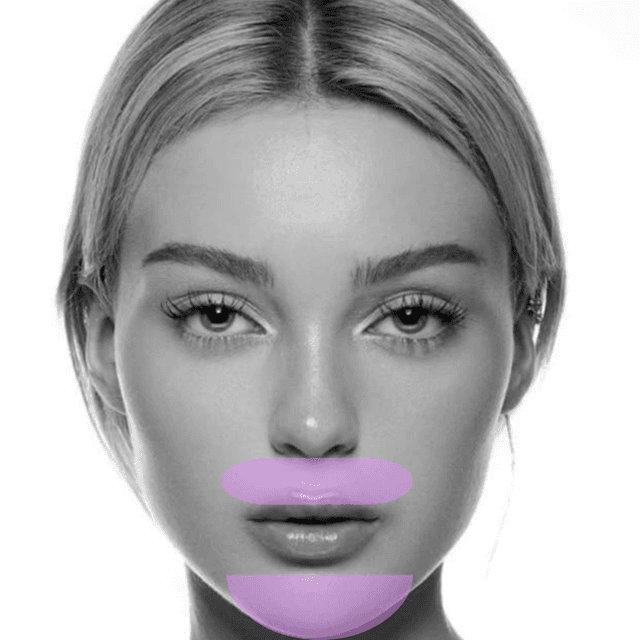 Lip & Chin Laser Hair Removal (3PK) at The Skin Addict by Megan in White Plains, NY