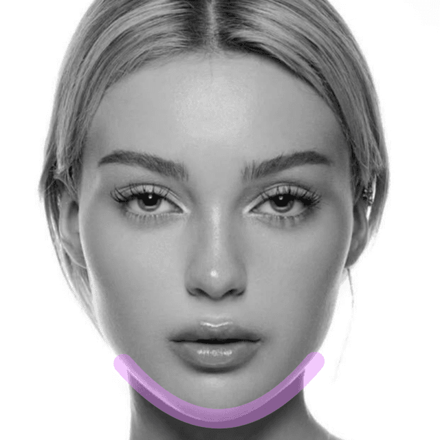 Jaw Laser Hair Removal (PK3) at The Skin Addict by Megan in White Plains, NY