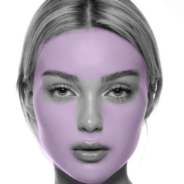 Full Face Laser Hair Removal (3PK) at The Skin Addict by Megan in White Plains, NY