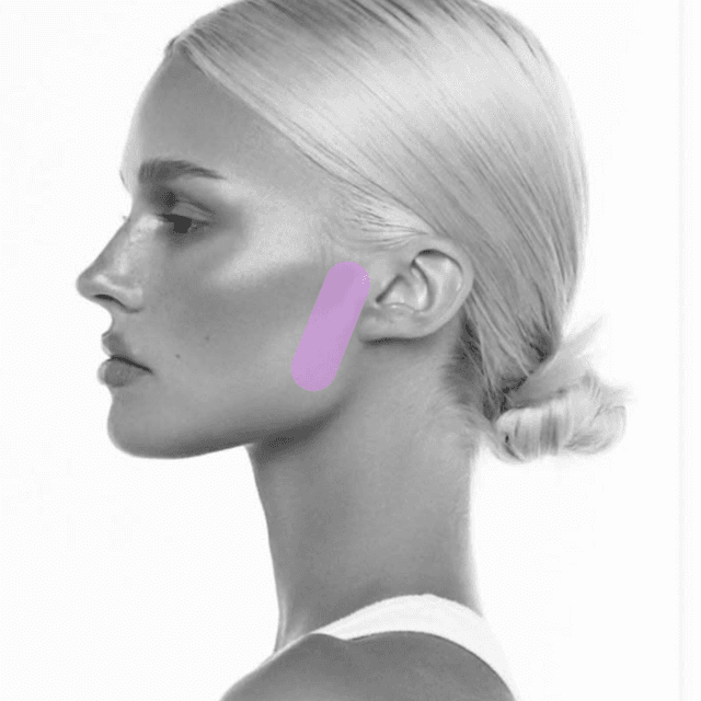 Sideburn Laser Hair Removal (3PK) at The Skin Addict by Megan in White Plains, NY