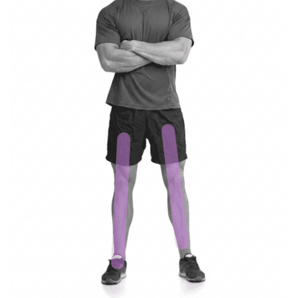 Full Leg (M) Laser Hair (3PK) at The Skin Addict by Megan in White Plains, NY
