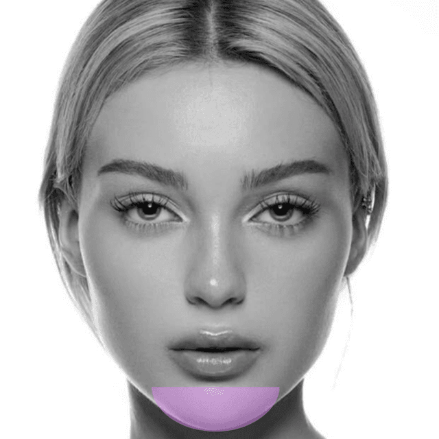 Chin Laser Hair Removal (3Pk) at The Skin Addict by Megan in White Plains, NY