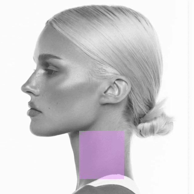 Neck Laser Hair Removal (3PK) at The Skin Addict by Megan in White Plains, NY