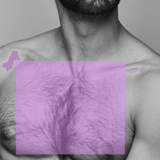 Chest (M) Laser Hair Removal(3PK) at The Skin Addict by Megan in White Plains, NY